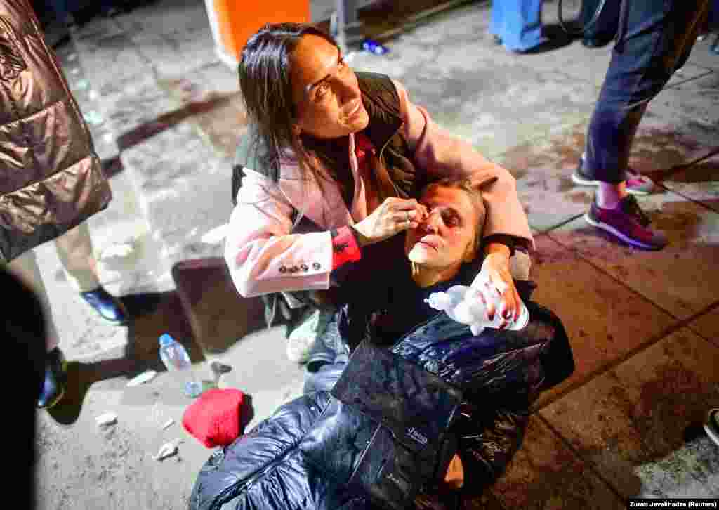 A woman who was affected by tear gas receives aid during the protest. Georgian President Salome Zurabishvili applauded the protesters while on a visit to the United States. "You represent a free Georgia, a Georgia which sees its future in the West, and won't let anyone to take this future away," she said in a video address. 