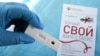 Роспотребнадзор: ВИЧ выявили у 1,5 миллиона россиян